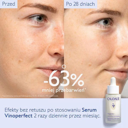 Caudalie Vinoperfect Serum rozjaśniające przebarwienia, 30ml