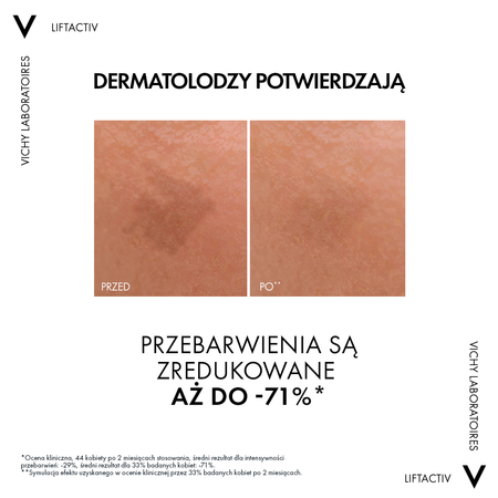 VICHY LIFTACTIV SPECIALIST B3 SERUM PRZEBARWIENIA I ZMARSZCZKI, 30ml │ Data ważności 10/2025 │