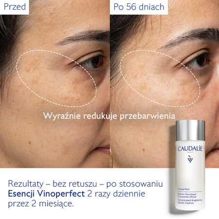 Caudalie Vinoperfect Skoncentrowana glikolowa esencja dodająca blasku, 100ml